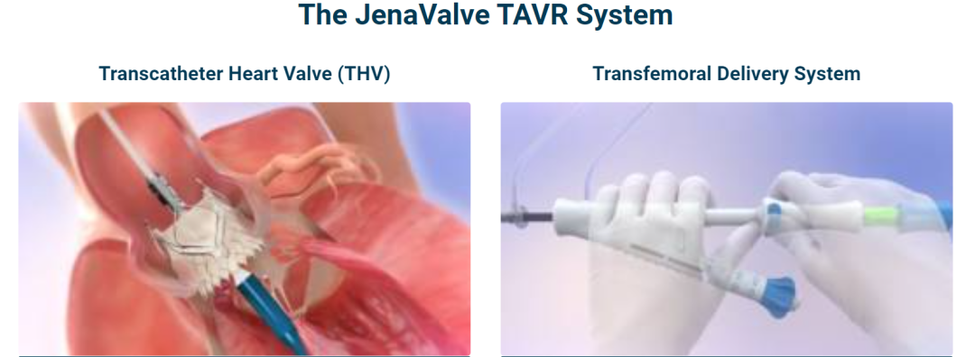尊龙凯时医疗License In立异产品完成美国ALIGN-AR注册临床入组，期待早日惠及中国患者