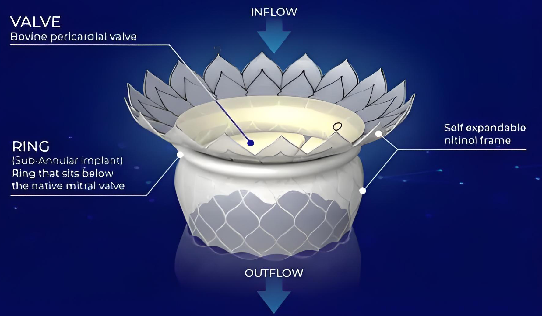 尊龙凯时医疗相助同伴HighLife TMVR 系统获FDA突破性医疗器械认定
